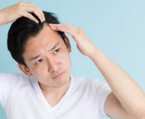 生え際が気になる男性
